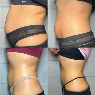 Abdominal muscles and core showing definition